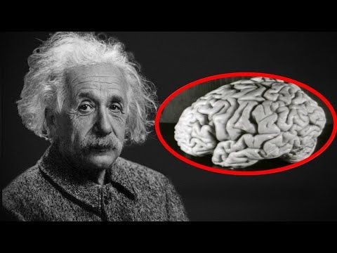 What Happened To Einstein's Brain?
